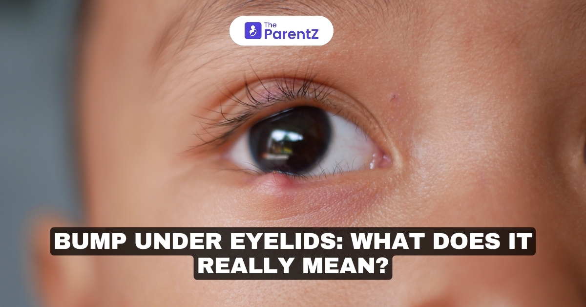 Bumps Under Eyelids: Here's What You Need To Know