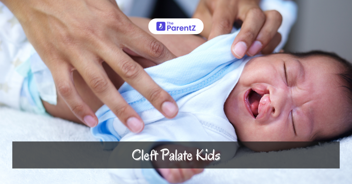 Cleft Palate Treatment in Kids: Comprehensive Care and Solutions