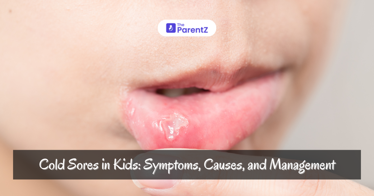 Cold Sores in Kids: Symptoms, Causes, and Effective Management