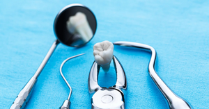 The Holistic Approach to Dental Care