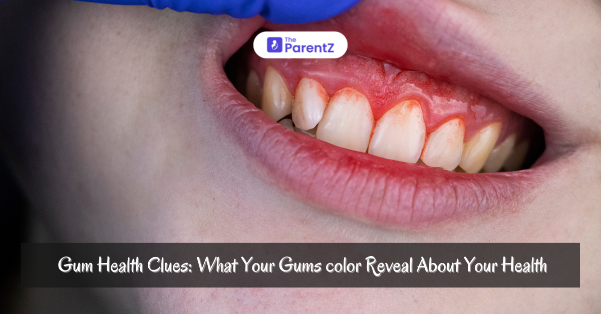 Gum Health: What Different Gum Colors Reveal About Your Oral Health