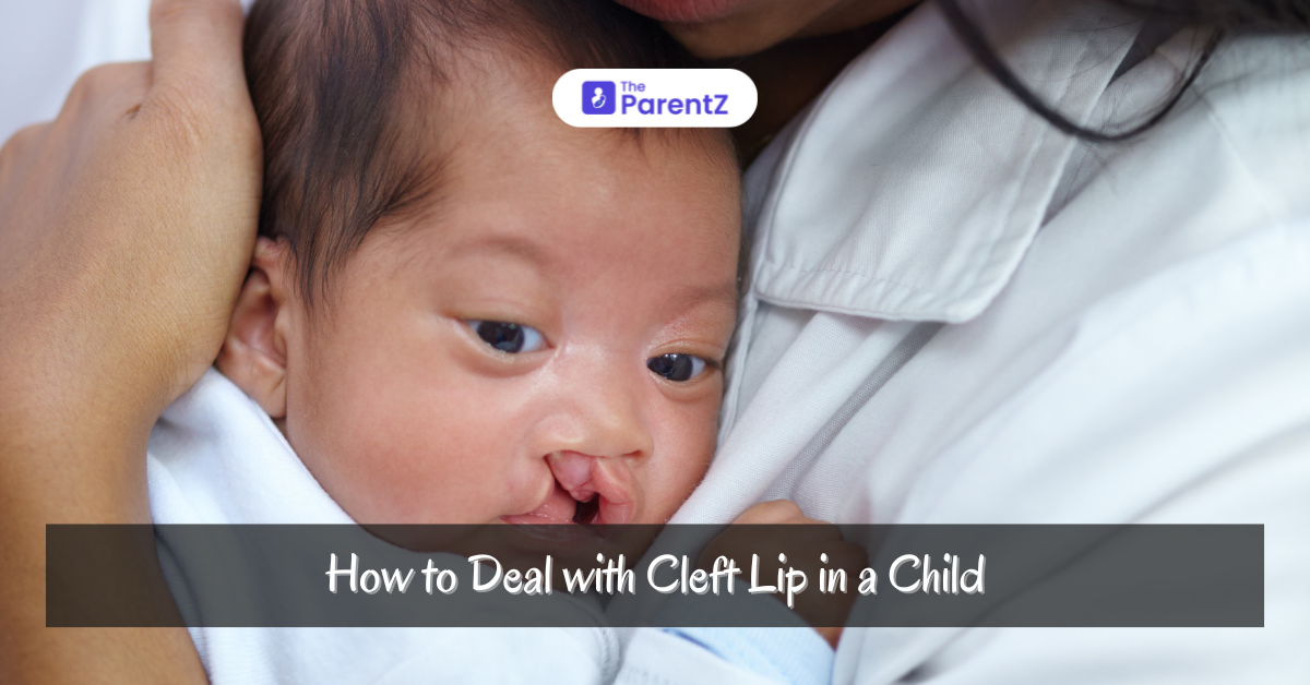 How to Effectively Manage Cleft Lip in Children: A Comprehensive Guide for Parents