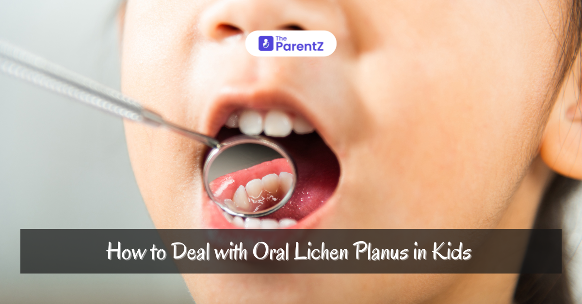 Understanding Oral Lichen Planus in Children