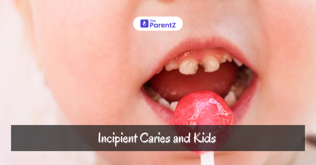 Incipient Caries and Kids: Early Signs and Prevention for Healthier Smile