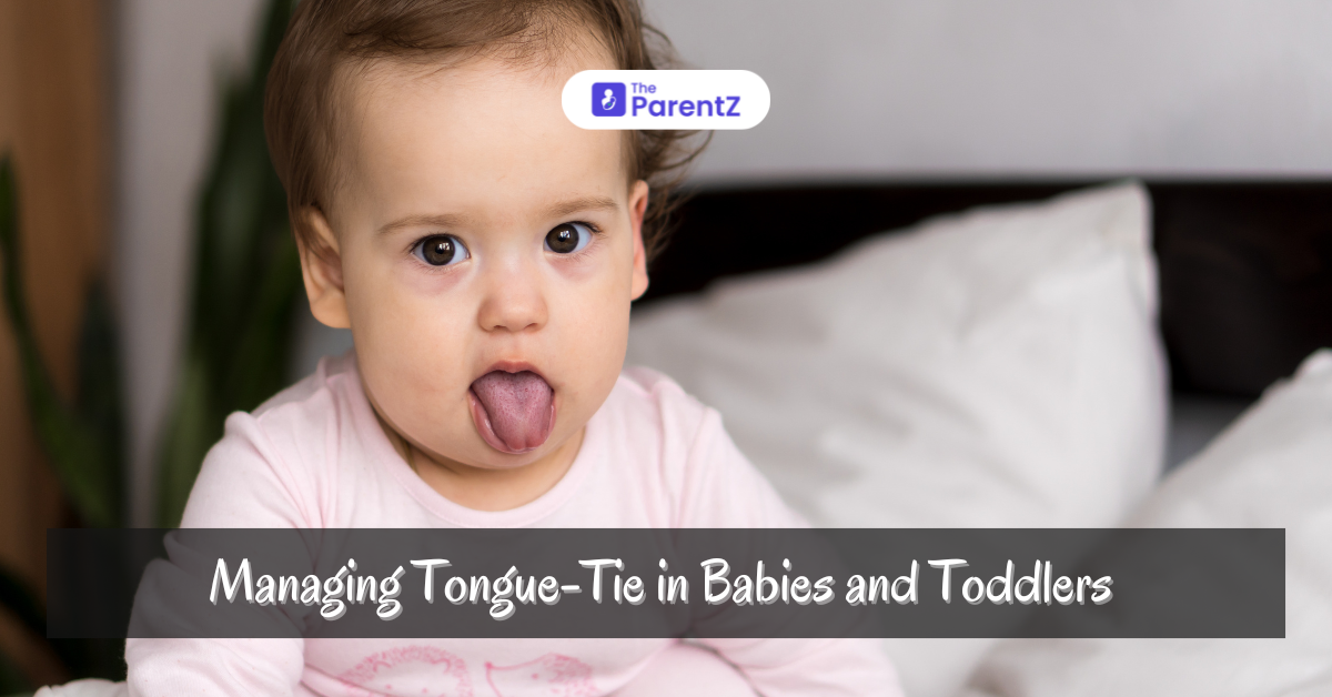 Managing Tongue Tie in Babies and Toddlers: Comprehensive Treatment and Prevention Guide