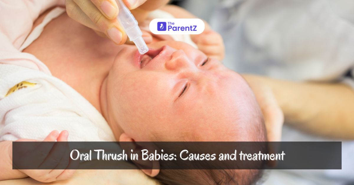 Oral Thrush in Babies: Causes, Symptoms, Risk Factors, and Treatment Options