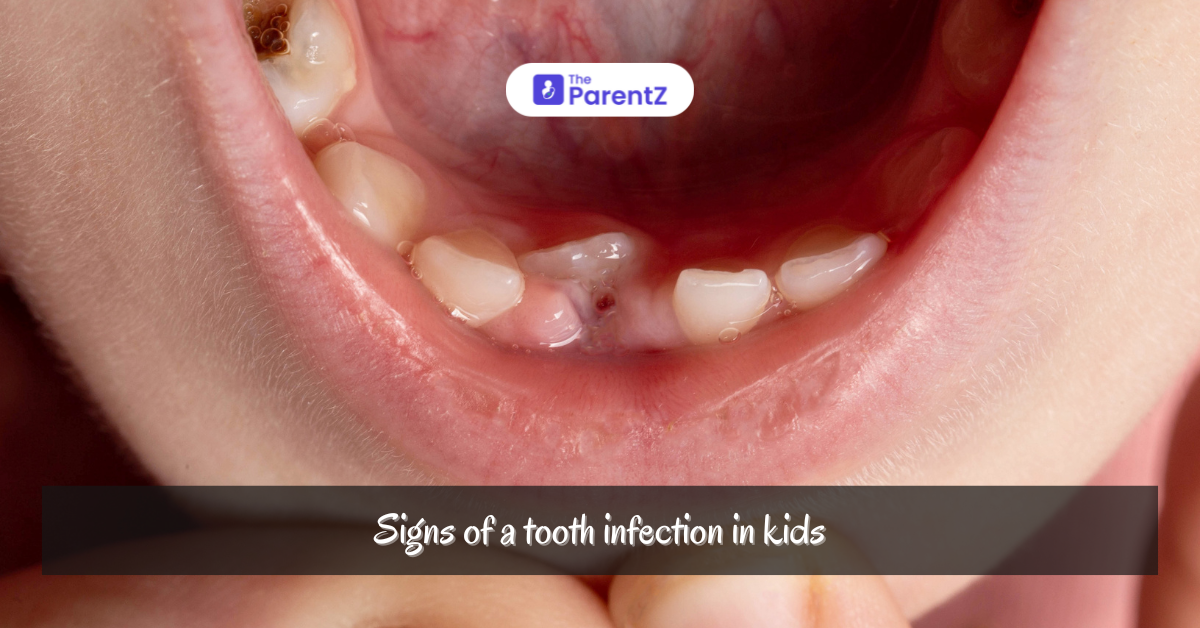 Signs of a Tooth Infection in Kids: Symptoms Every Parent Should Know