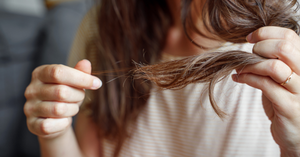 Stress-Related Hair Loss: Managing Stress and Preventing Hair Fall