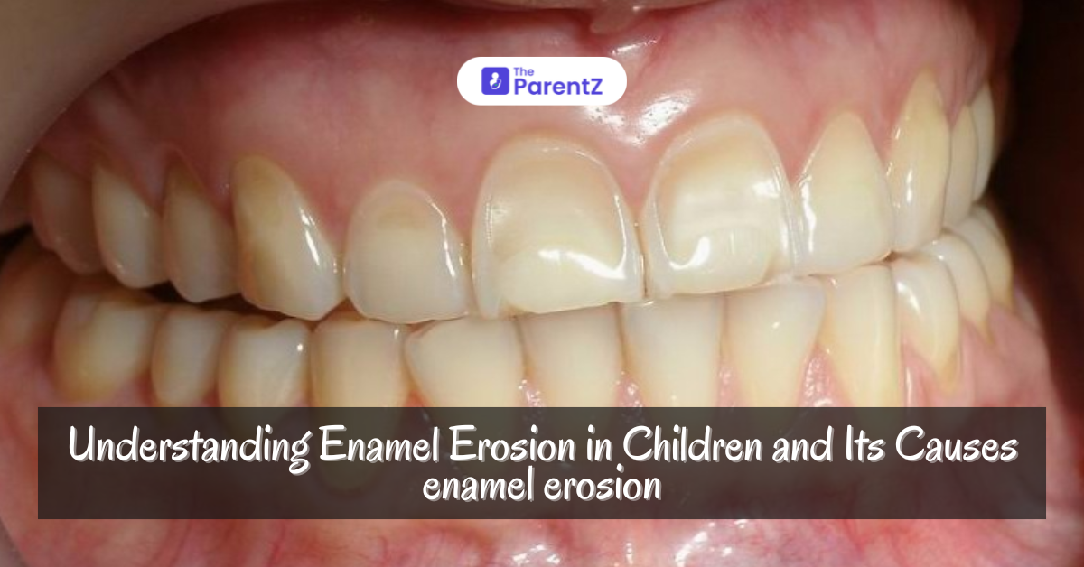 Understanding Enamel Erosion in Children and Its Cause