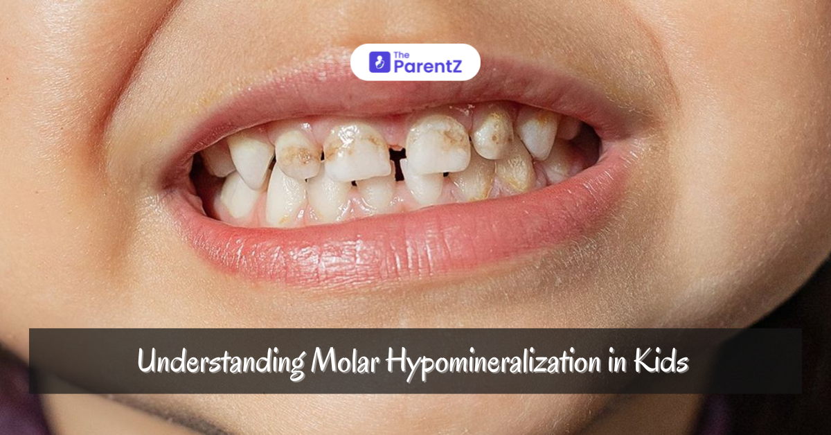Understanding Molar Hypomineralization in Kids