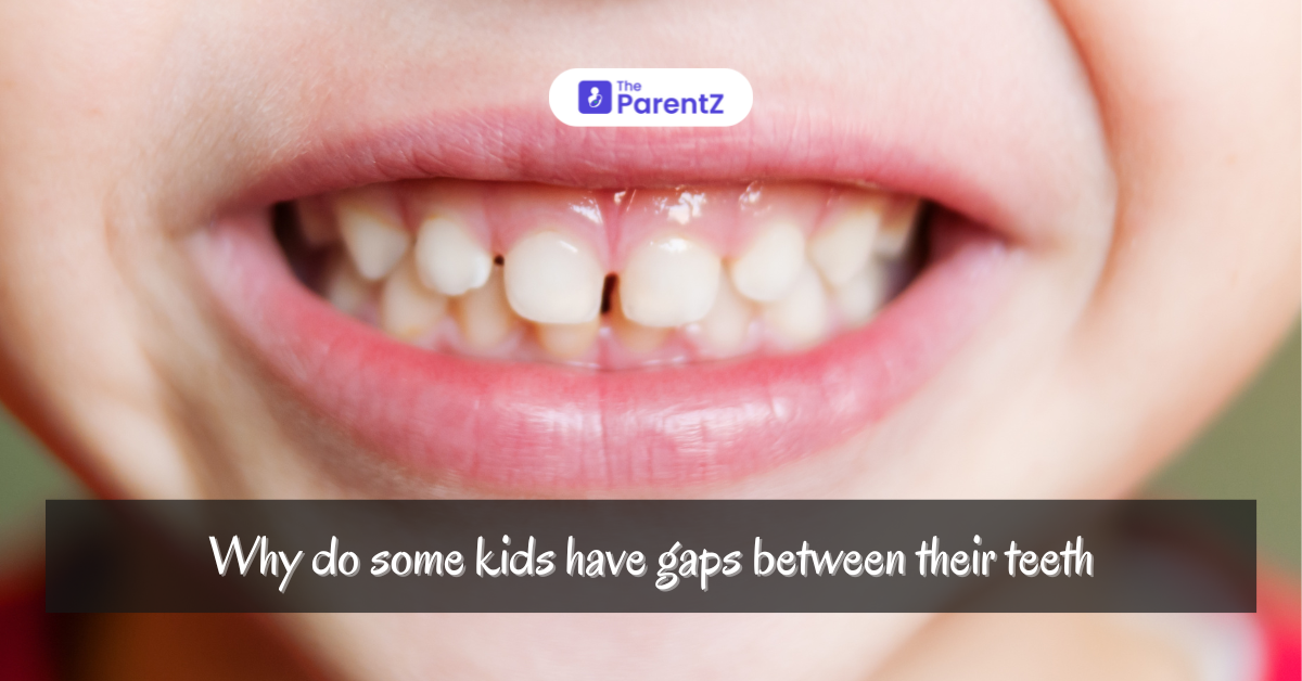 Why Do Some Kids Have Gaps in Their Teeth? 
