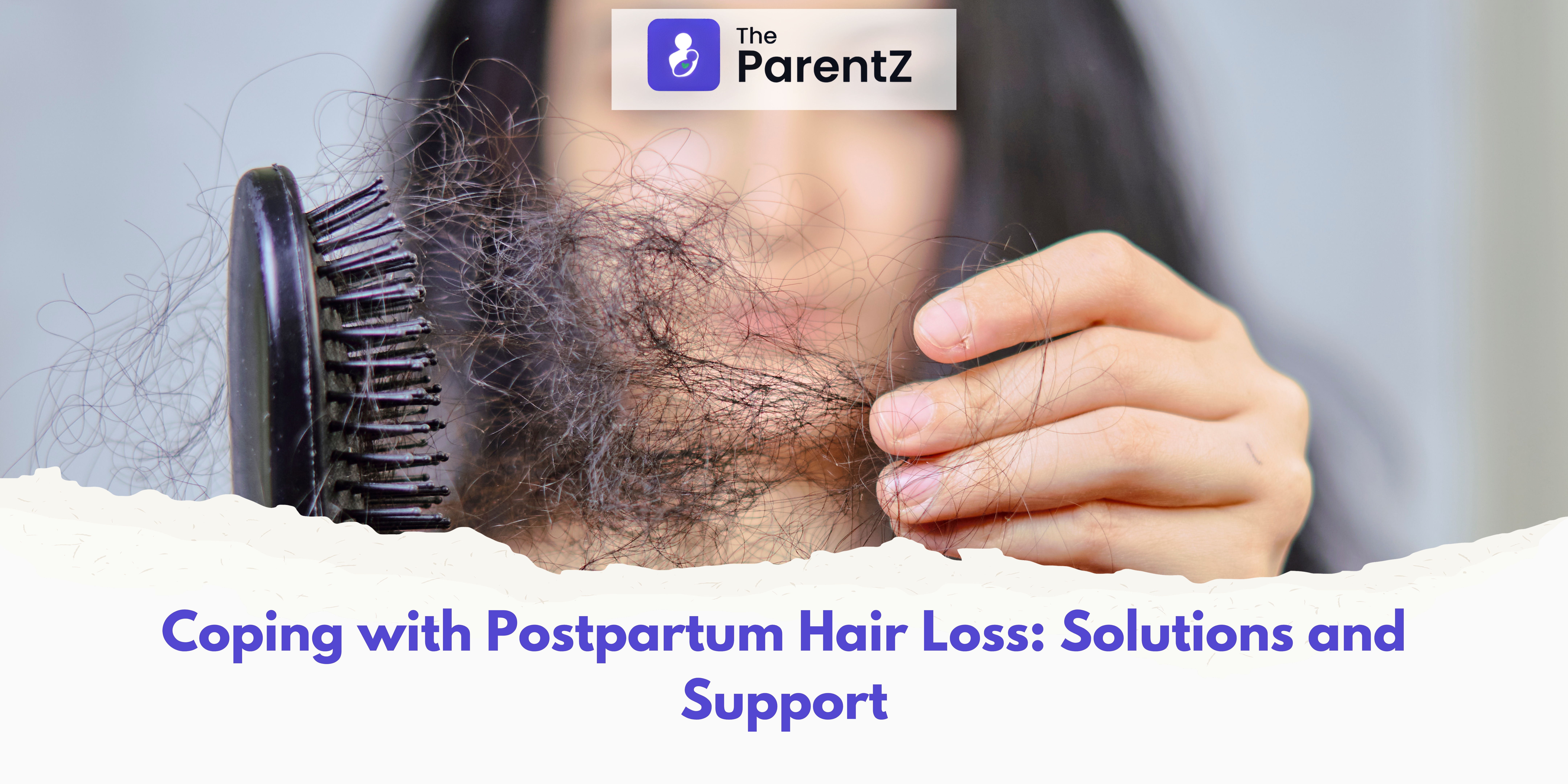 Coping with Postpartum Hair Loss: Solutions and Support