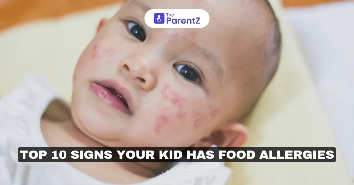 Top 10 Signs Your Kid Has Food Allergies