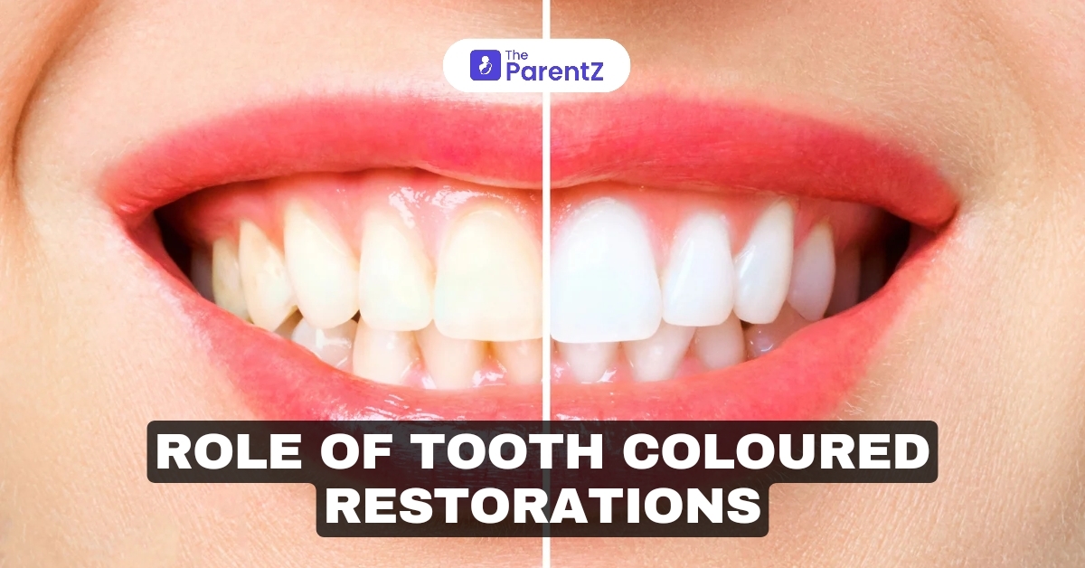 The Role of Tooth-Colored Restorations