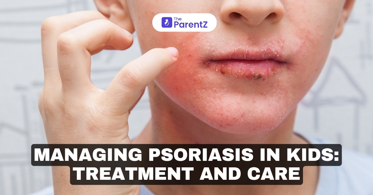 Managing Psoriasis in Kids: Treatment and Care