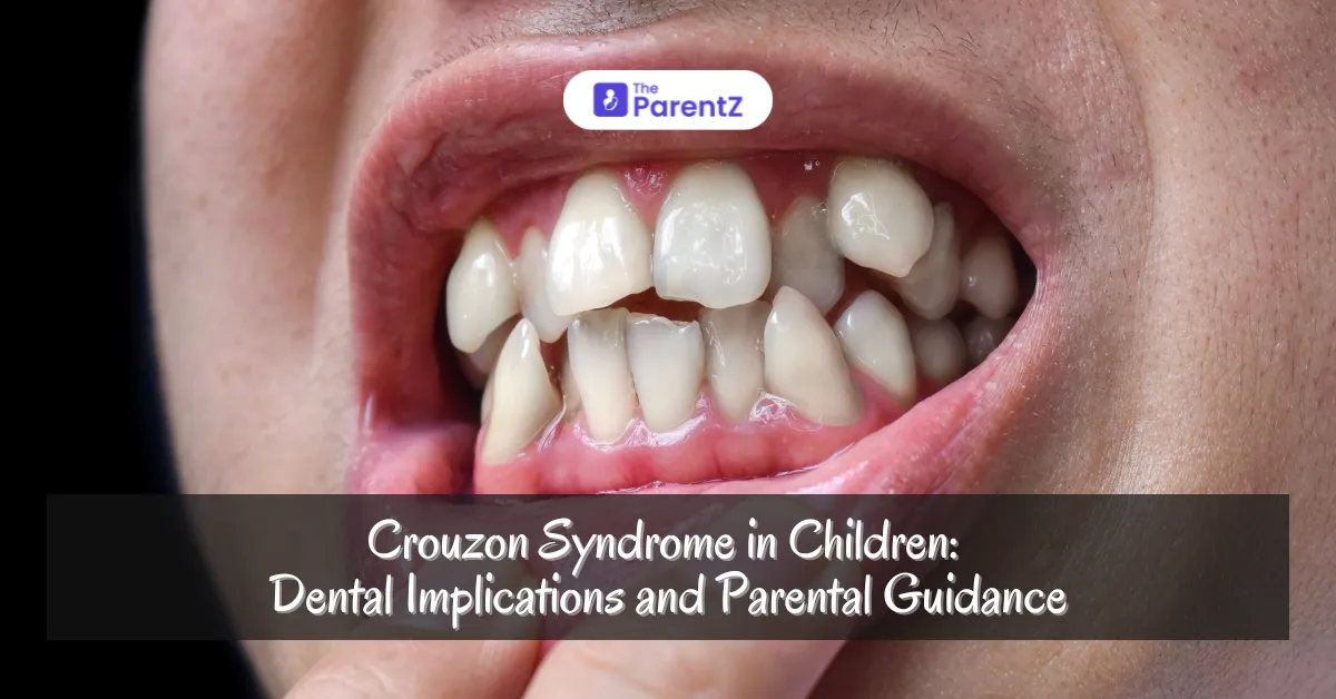 Crouzon Syndrome in Children: Dental Implications and Parental Guidance