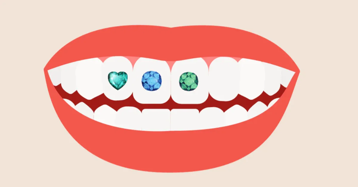 Dental Jewels for Kids Fun Facts, Safety, and What to Know