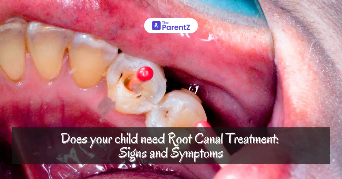 Does your child need  Root Canal Treatment: signs and symptoms