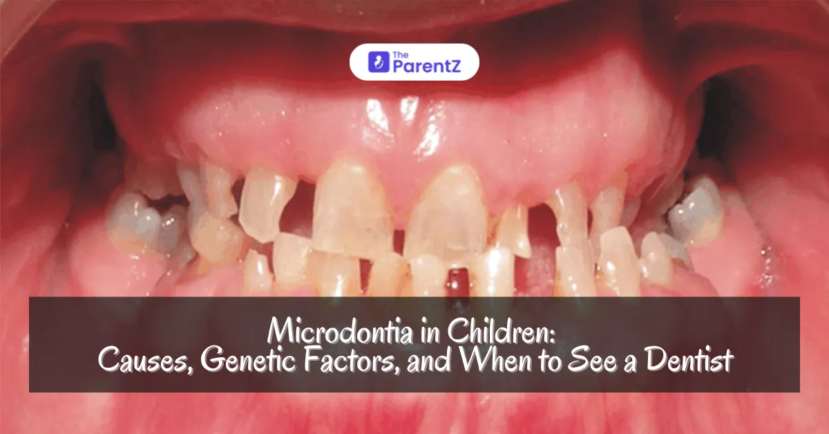 Microdontia in Children: Causes, Genetic Factors, and When to See a Dentist