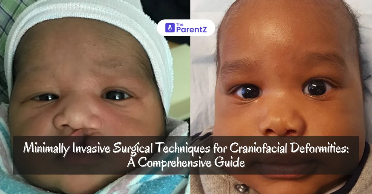 Minimally Invasive Surgical Techniques for Craniofacial Deformities: A Comprehensive Guide