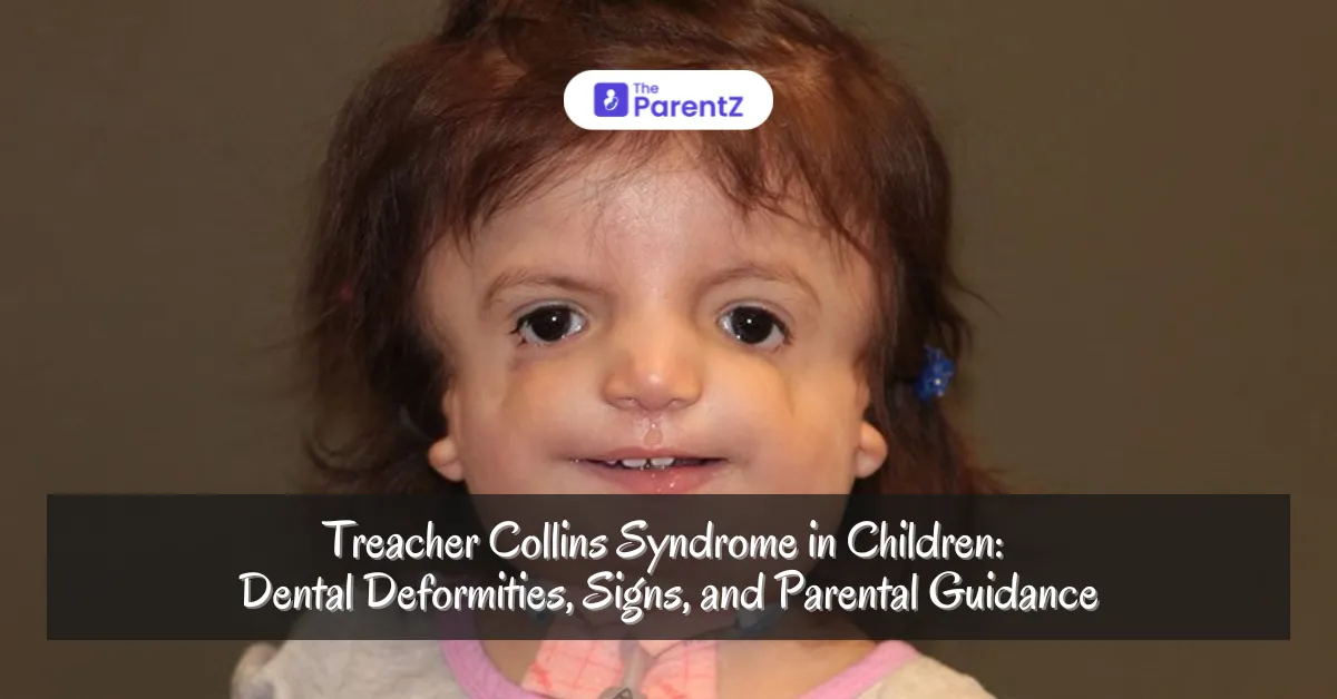 Treacher Collins Syndrome in Children: Dental Deformities, Signs, and Parental Guidance