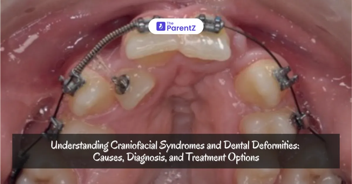 Understanding Craniofacial Syndromes and Dental Deformities: Causes, Diagnosis, and Treatment Options