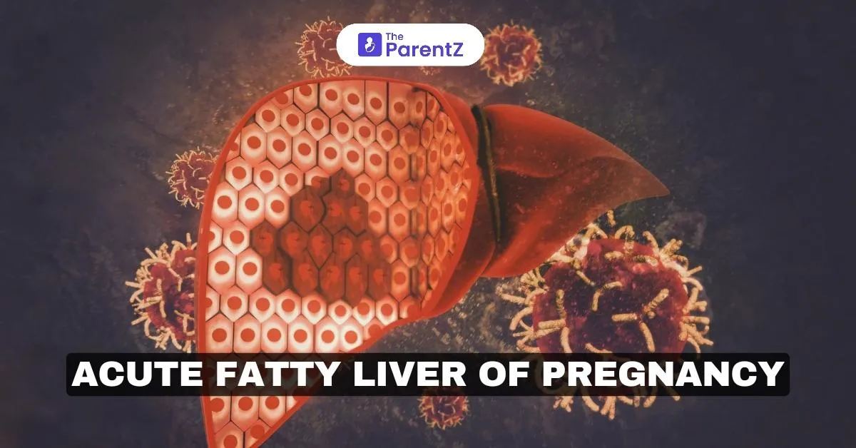 Acute fatty liver of pregnancy