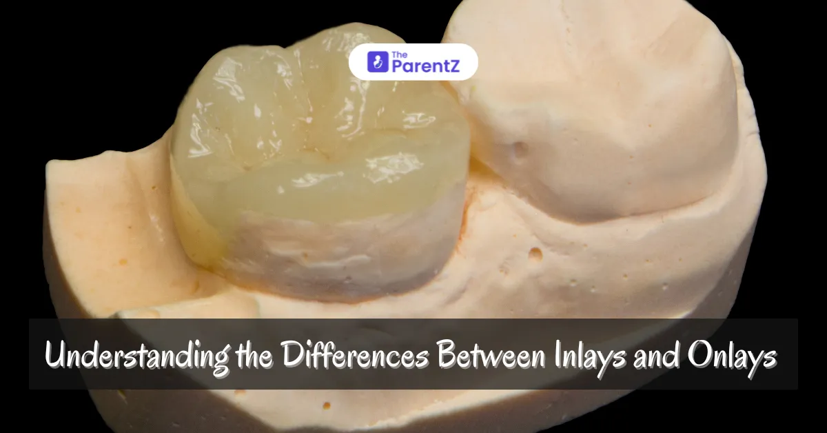 Inlays vs. Onlays: Key Differences Explained