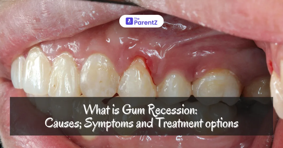 What  is Gum Recession: Causes, symptoms and treatment options