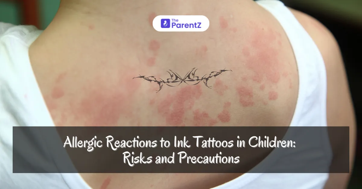 Allergic Reactions to Ink Tattoos in Children: Risks and Precautions