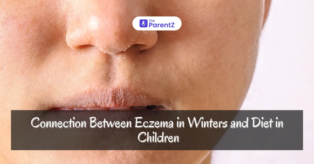 Connection Between Eczema in Winters and Diet in Children