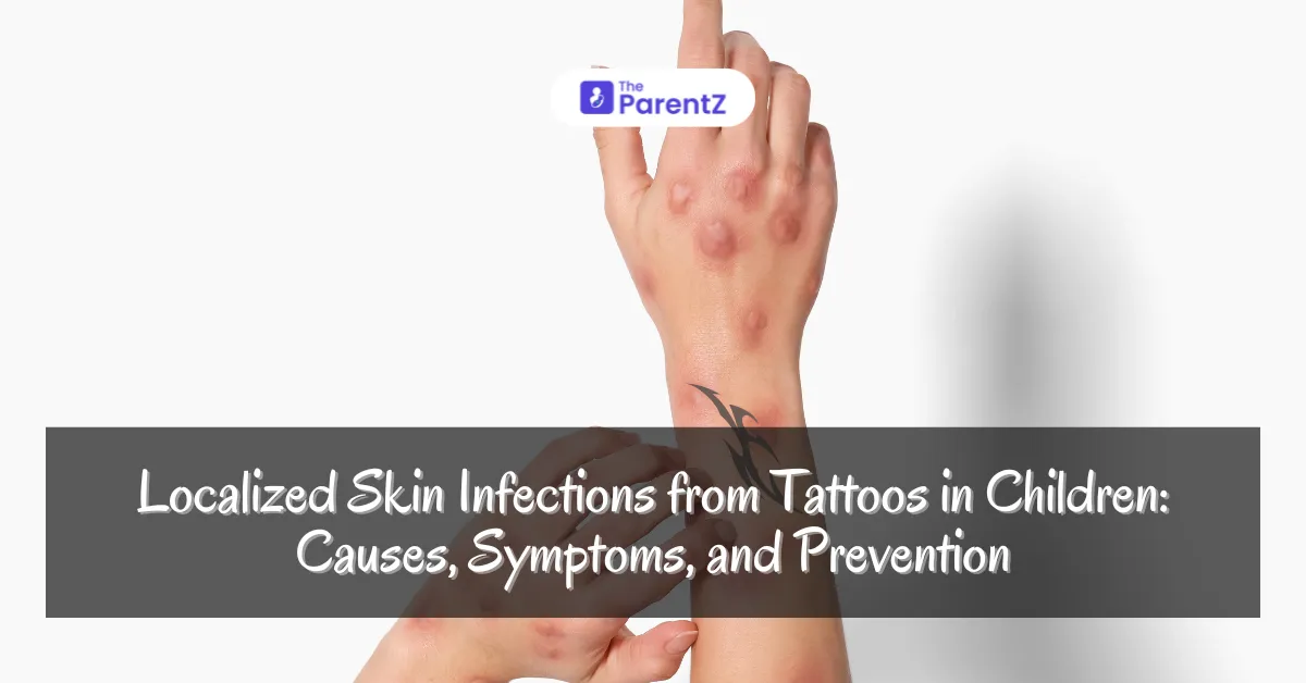 Localized Skin Infections from Tattoos in Children: Causes, Symptoms, and Prevention
