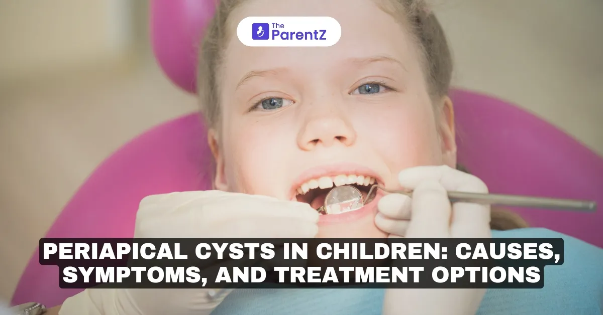 Periapical Cysts in Children: Causes, Symptoms, and Treatment Options