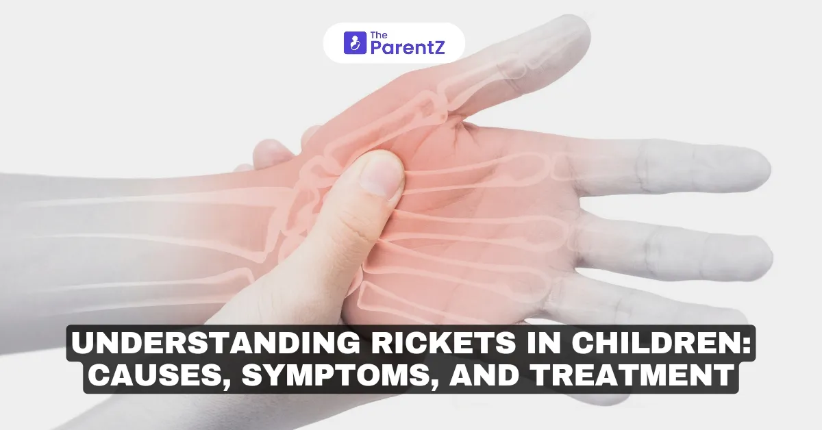 Understanding Rickets in Children: Causes, Symptoms, and Treatment