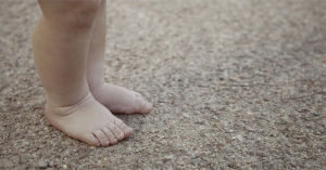 Top Myths About Limb Issues in Kids Debunked: Facts Every Parent Should Know