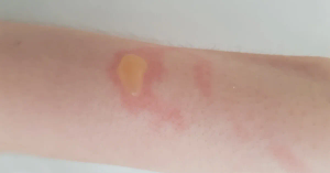 Essential Kitchen Safety Tips to Prevent Child Burn Injuries