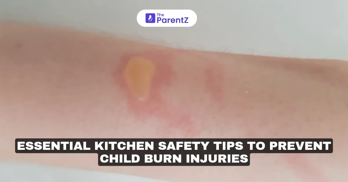 Essential Kitchen Safety Tips to Prevent Child Burn Injuries