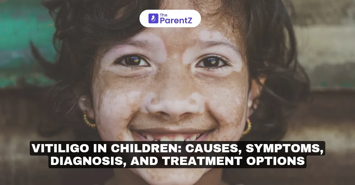 Vitiligo in Children: Causes, Symptoms, Diagnosis, and Treatment Options