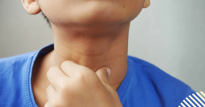 How To Treat and Prevent Strep Throat in Kids
