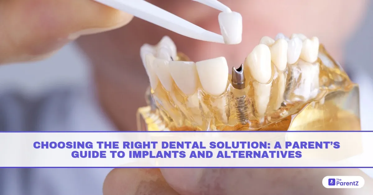Choosing the Right Dental Solution: A Parent’s Guide to Implants and Alternatives
