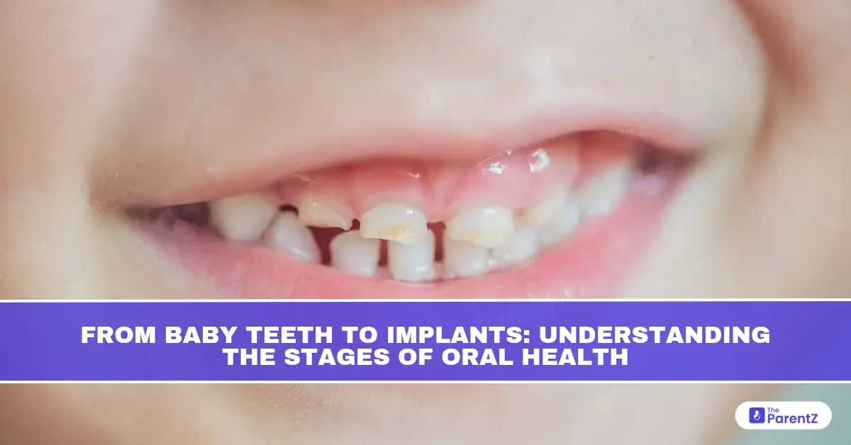 From Baby Teeth to Implants: Understanding the Stages of Oral Health