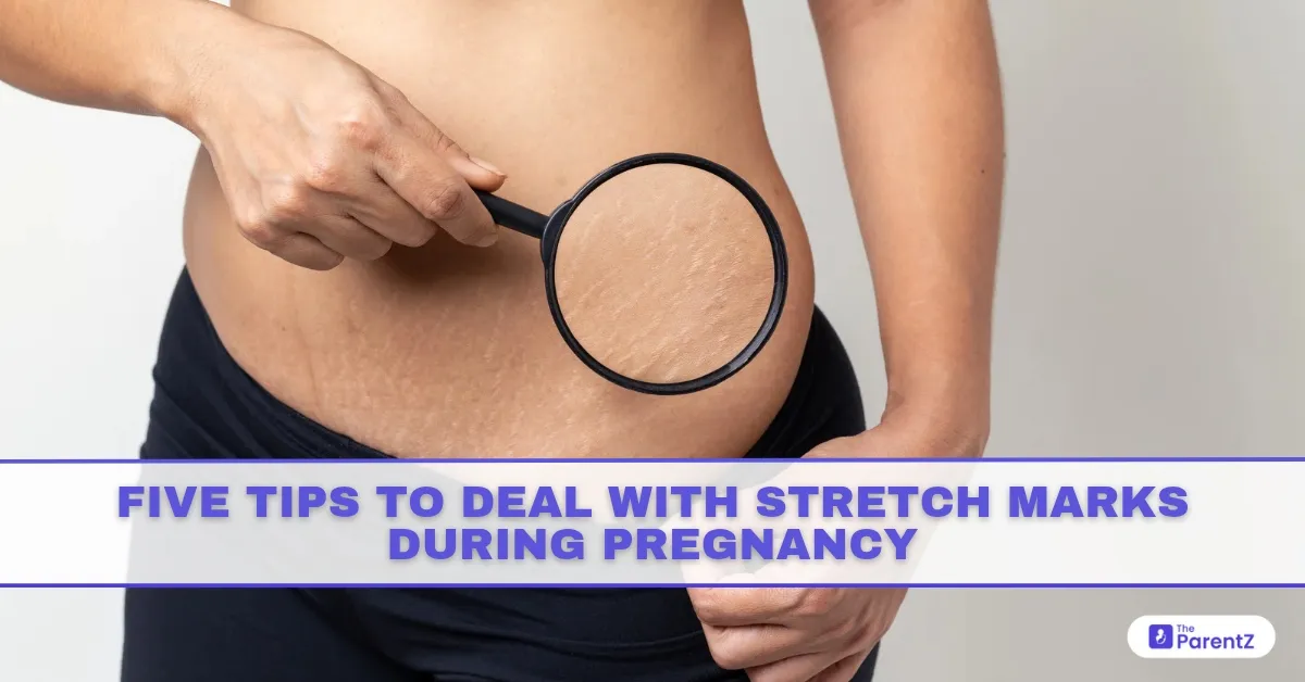 Five Tips To Deal With Stretch Marks During Pregnancy