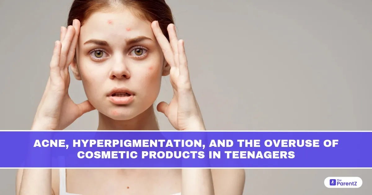 Acne, Hyperpigmentation, and the Overuse of Cosmetic Products in Teenagers