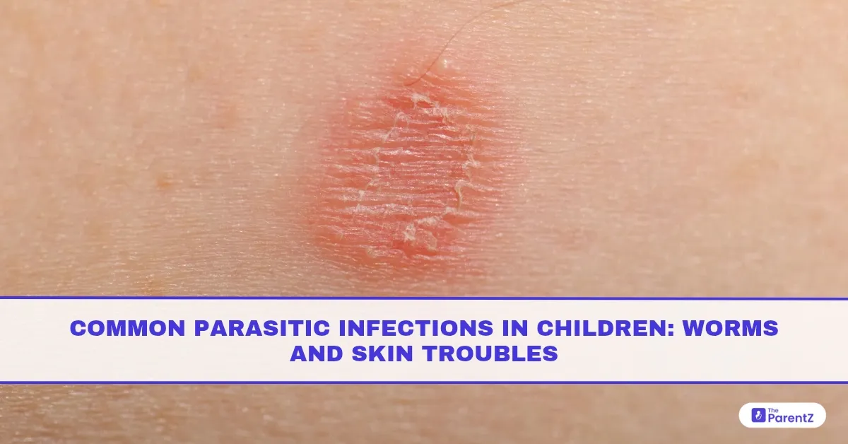 Common Parasitic Infections in Children: Worms and Skin Troubles