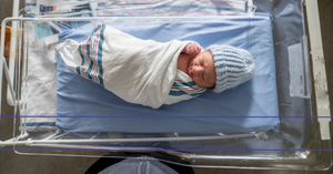 From Jaundice to Journey: How Home Phototherapy is Changing Newborn Care