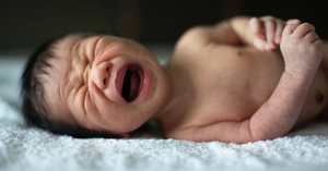 Hydrocele in Newborns: A Gentle Guide for Parents