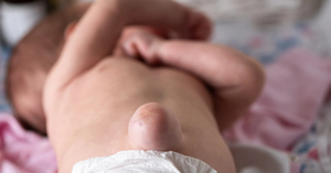 Inguinal Hernia in Newborns: What Every Parent Should Know