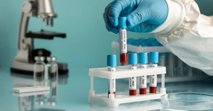 No More Tears: Painless Blood Tests and Gentle Procedures for Kids