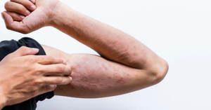 Stop The Rub: Essential Tips For Preventing Chafing For Active Parents