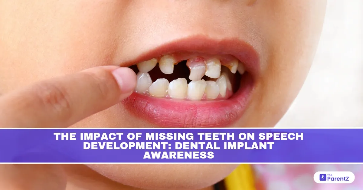 The Impact of Missing Teeth on Speech Development: Dental Implant Awareness